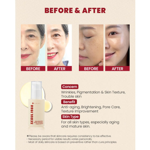 K-SECRET SEOUL 1988 Serum: Retional Liposome 2% + Black Ginseng Benefts