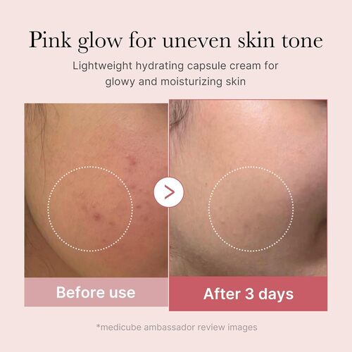 Medicube - PDRN Pink Collagen Capsule Cream After Use