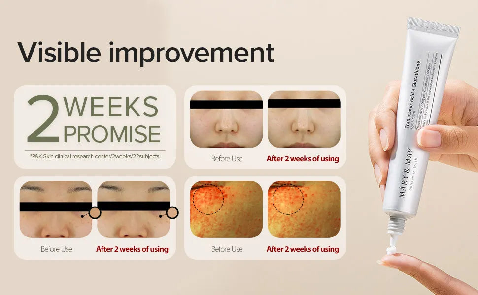 Mary & May - Tranexamic Acid+ Glutathion Eye Cream Visible improvement