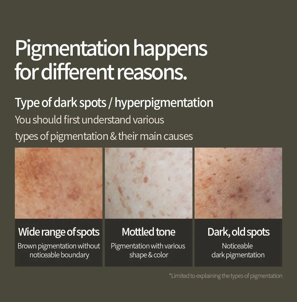 ANUA - Green Lemon Vitamin C Serum - Types of dark spots