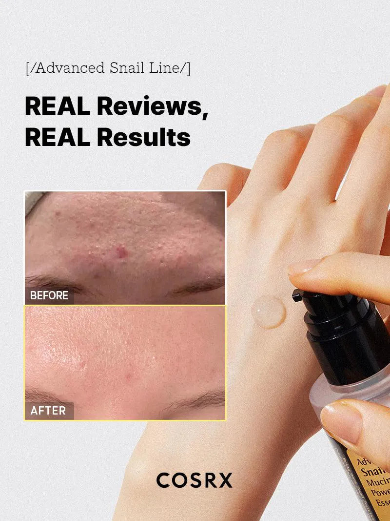 COSRX - Advanced Snail 96 Mucin Power Essence Real reviews