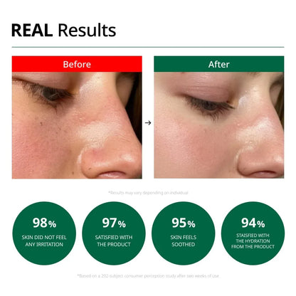 Dr.G red blemish clear soothing cream 70ml real results