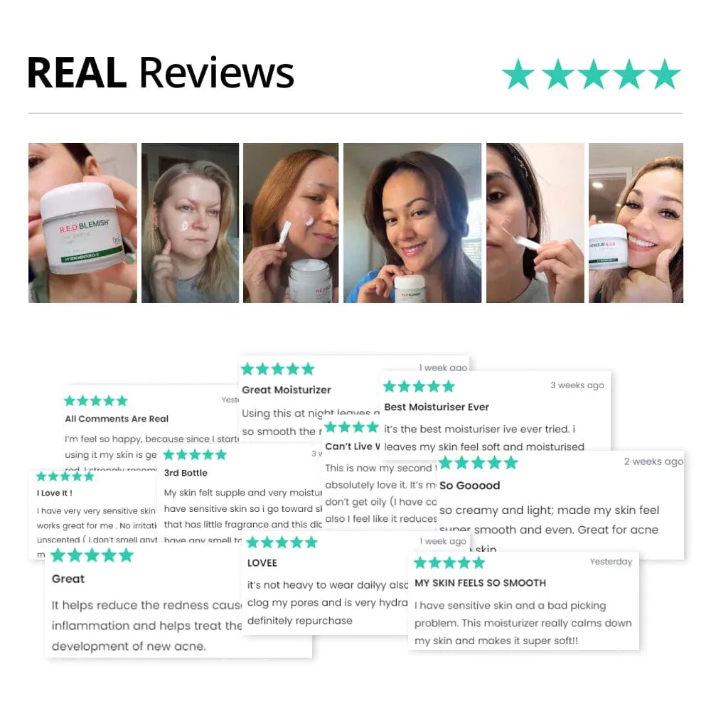 Dr.G red blemish clear soothing cream 70ml real reviews