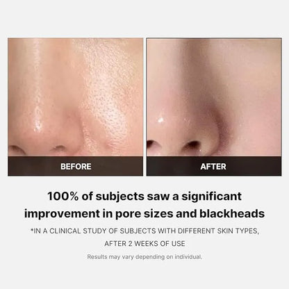 Medicube - Zero Pore Pads 2.0 before and after