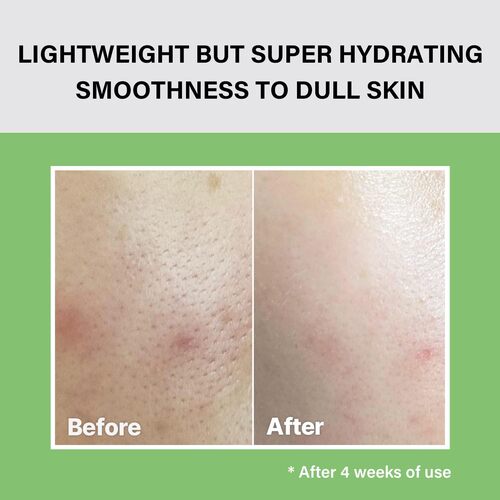 celimax The Real Noni Moisture Balancing Toner 150ml