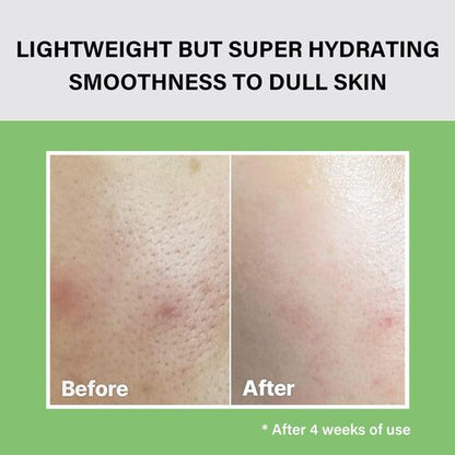 celimax The Real Noni Moisture Balancing Toner 150ml