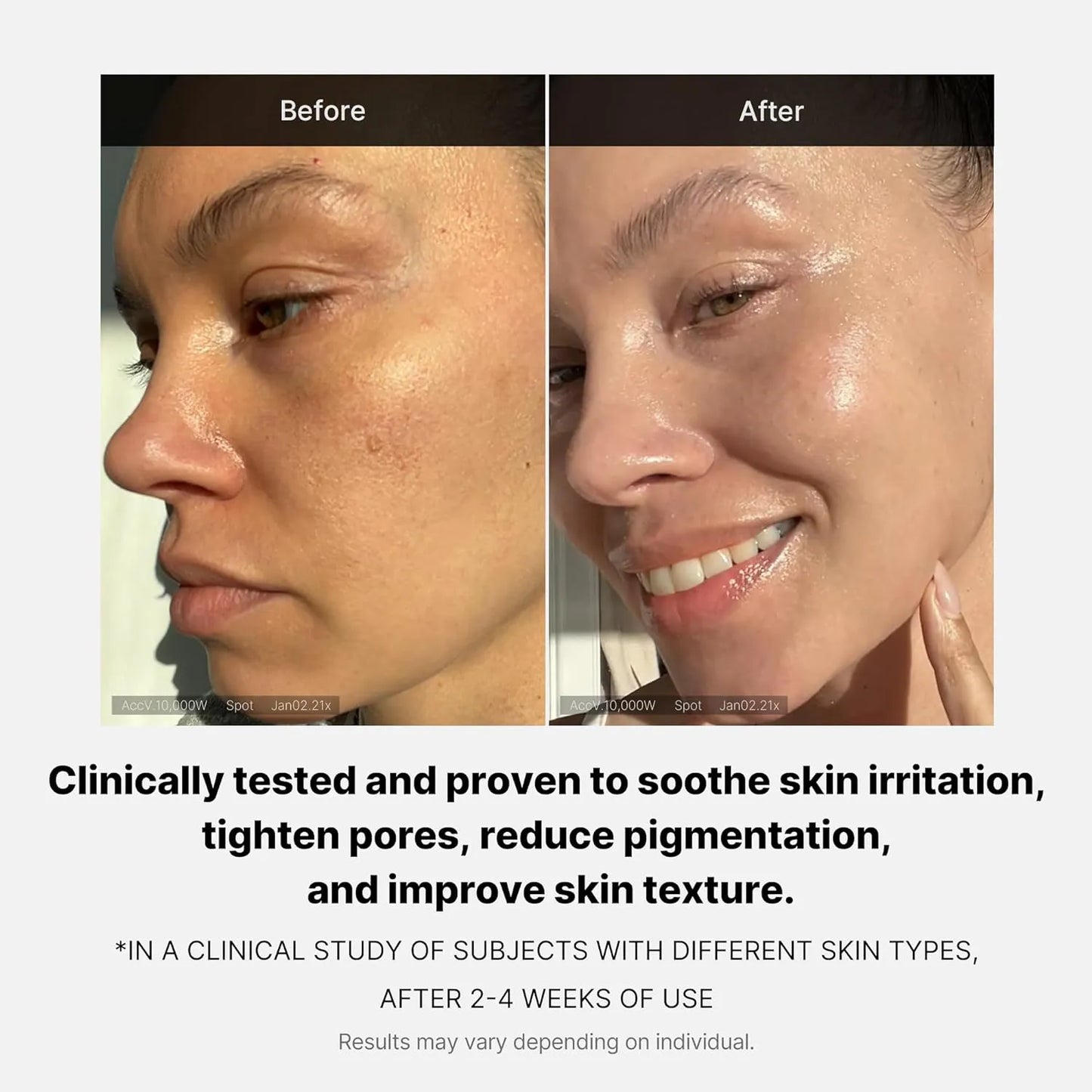 Medicube - Triple Collagen Cream before and after